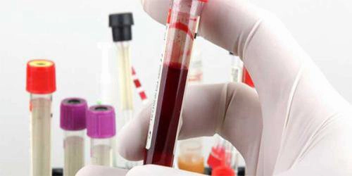 Chỉ số HBV DNA 80,000/ml có ý nghĩa gì?