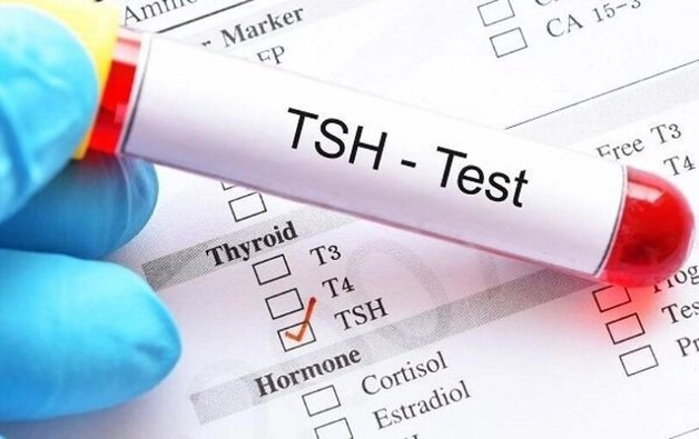 Chỉ số xét nghiệm tuyến giáp tăng nhẹ nên làm gì?
