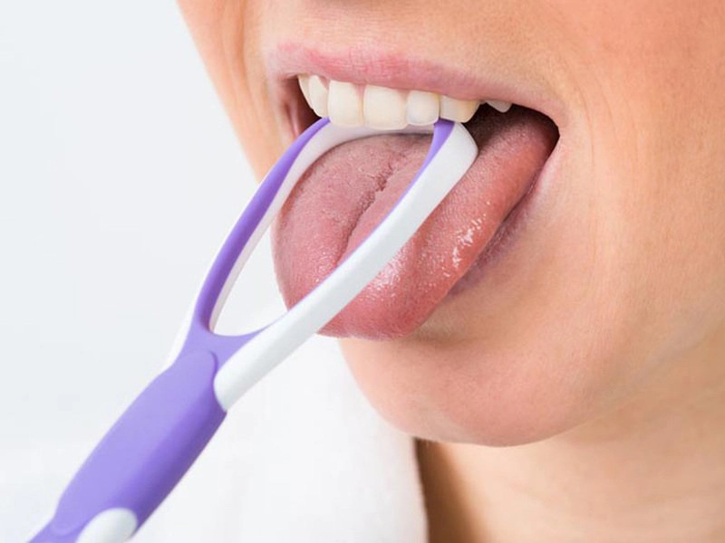 Có cần cạo lưỡi hàng ngày sau khi đánh răng?