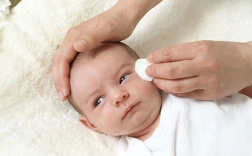 Có cần dùng thuốc nhỏ mắt chữa tắc tuyến lệ cho trẻ?