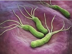 Cơ chế bệnh sinh của ban xuất huyết Henoch-Schonlein và nhiễm H.pylori