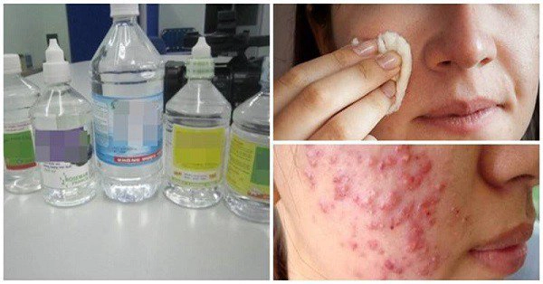 Có thể dùng nước muối sinh lý để rửa mặt?