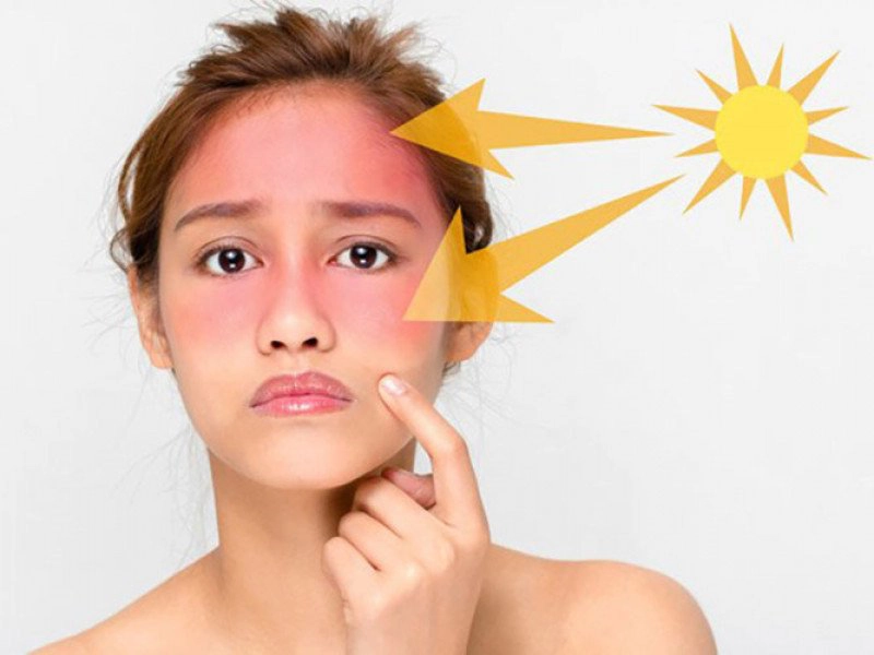 Da mặt bị cháy nắng làm sao để trắng lại?