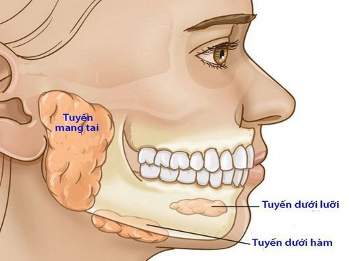 Đau do nhiễm trùng khoang dưới hàm