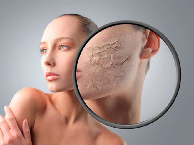 Dấu hiệu nhận biết da thiếu nước