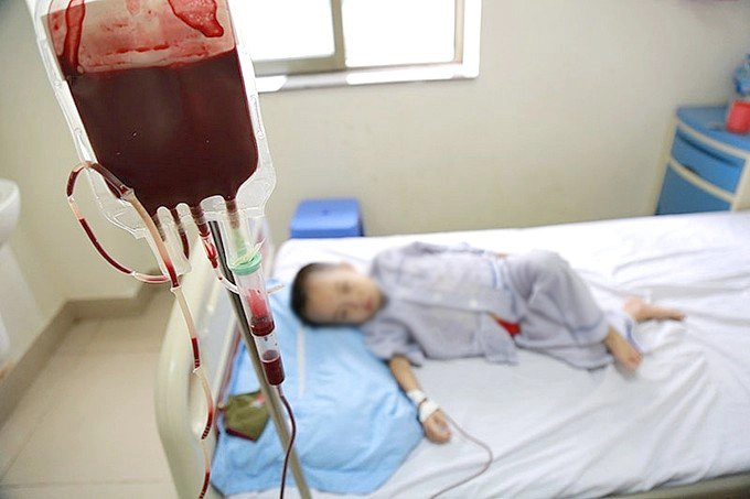 Dấu hiệu trẻ thiếu sắt