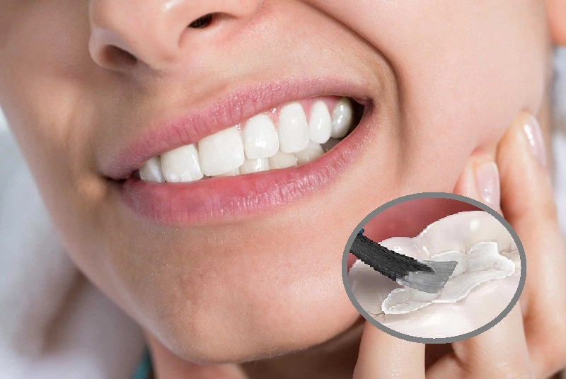 Đau nhức răng kèm đau đầu là bệnh gì?