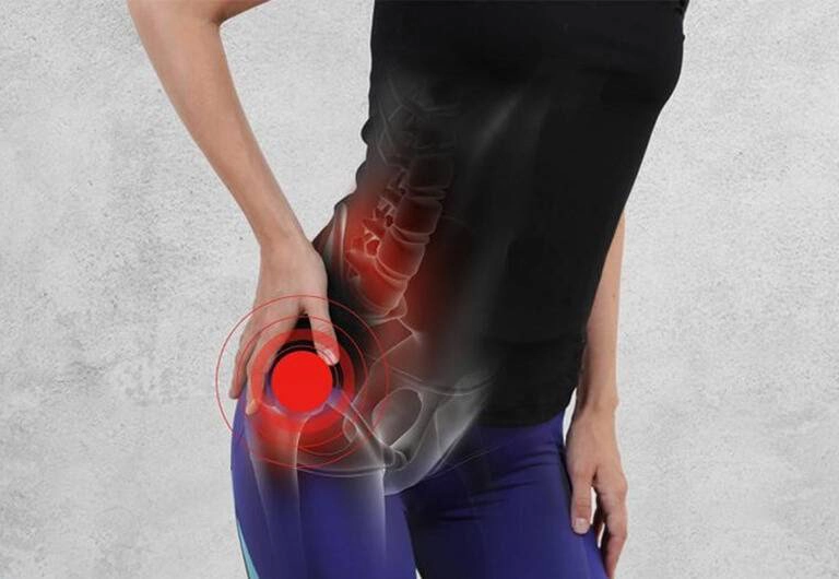 Đau thần kinh tọa có nguy hiểm không?