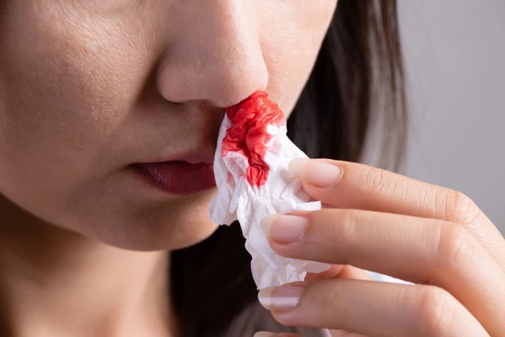 Đột nhiên chảy máu mũi là do đâu?