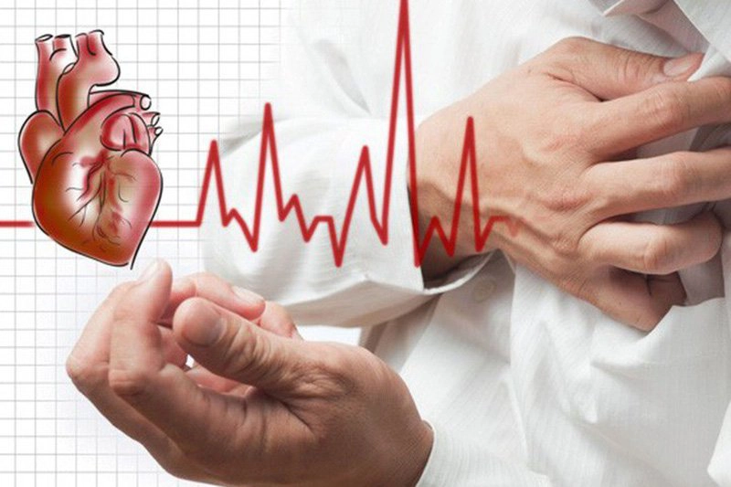 Đột quỵ có thể phòng ngừa