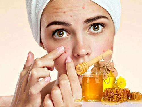 Dùng cách trị mụn bằng mật ong có tốt không?