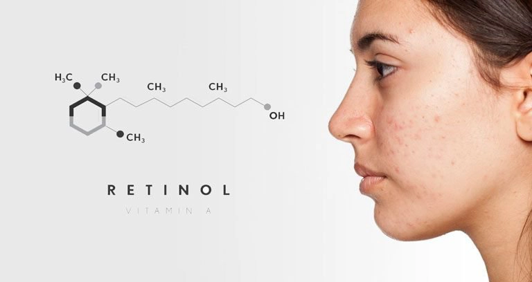 Dùng retinol xong có phải tắt đèn không?