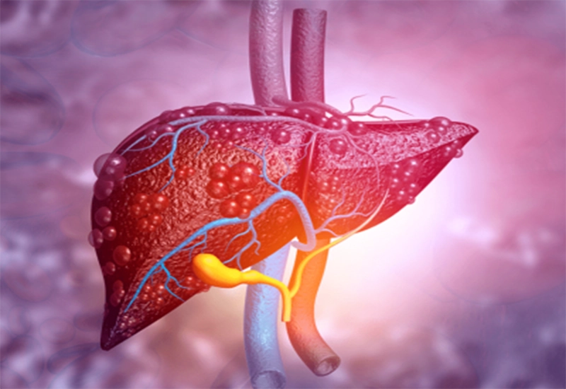 Elastography là gì?