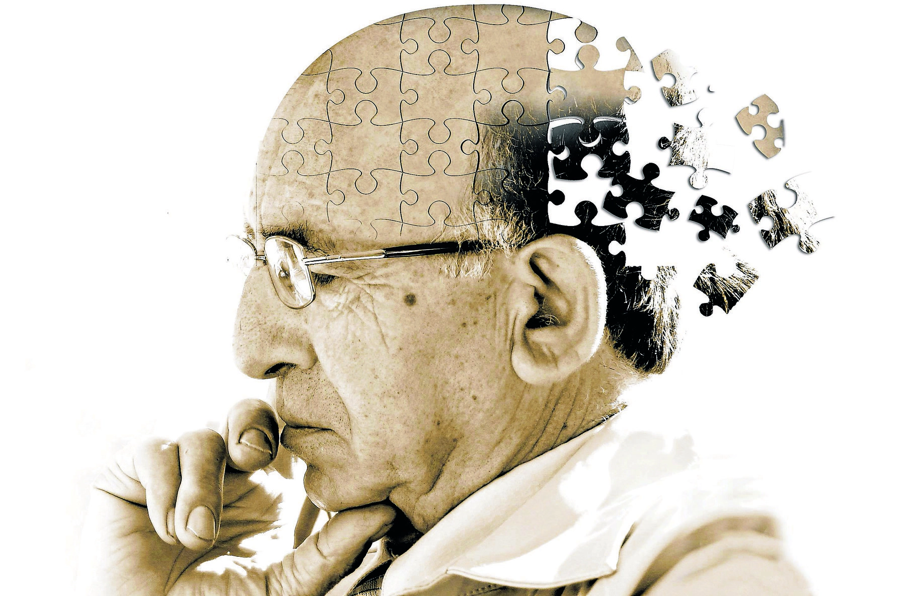 Gây mê có làm tăng nguy cơ mắc bệnh Alzheimer?