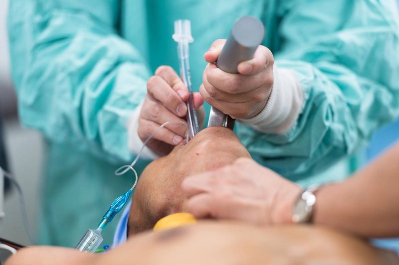 Gây mê nội khí quản mổ u não có biến chứng nguy hiểm không?