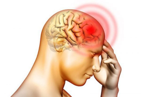 Hãy thận trọng nếu bạn đã từng có các dấu hiệu của cơn thiếu máu não thoáng qua