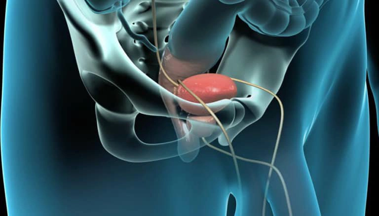 Hiểu về báo cáo kết quả giải phẫu các bệnh tuyến tiền liệt lành tính