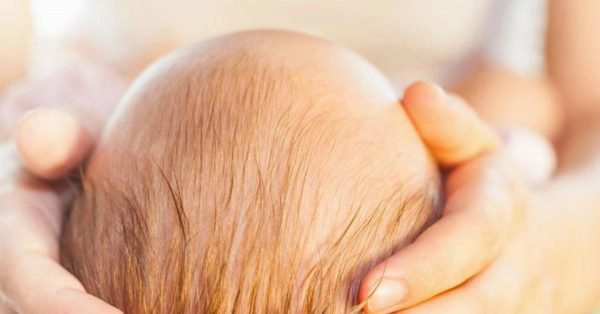 Hội chứng đầu phẳng ở trẻ em