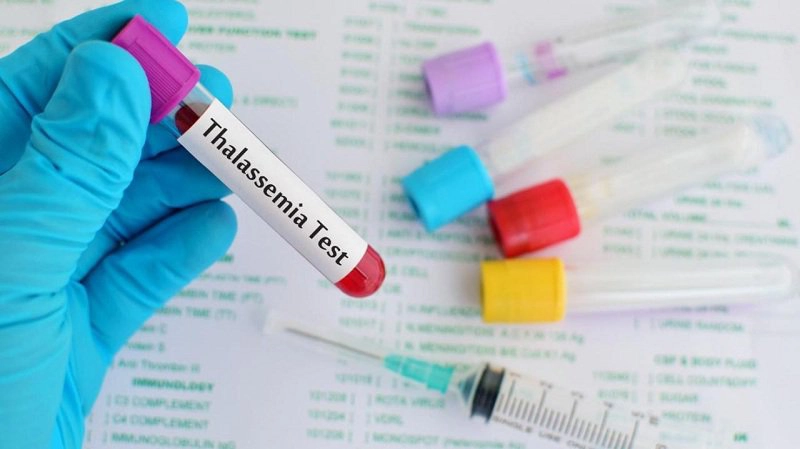 Hồng cầu nhỏ thì bệnh Thalassemia ở dạng biến thể nào?