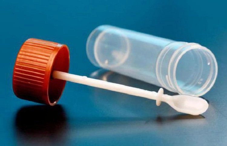 Hướng dẫn cách lấy phân xét nghiệm