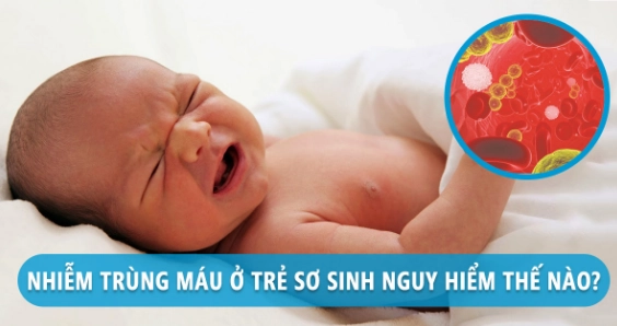 Hướng dẫn chăm sóc trẻ bị nhiễm trùng máu
