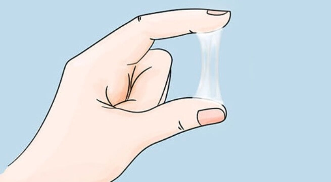 Huyết trắng ra nhiều: Khi nào nguy hiểm?