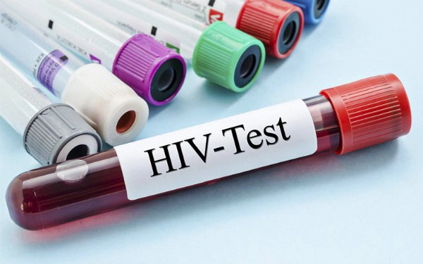 Kết quả xét nghiệm HIV như thế nào là nguy hiểm?