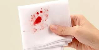 Khạc đờm ra máu kèm khó thở có phải ung thư vòm họng không?