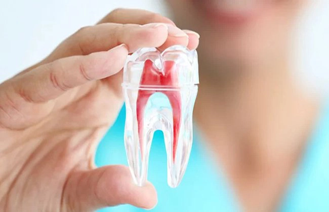 Khi lấy tủy răng có đau không?
