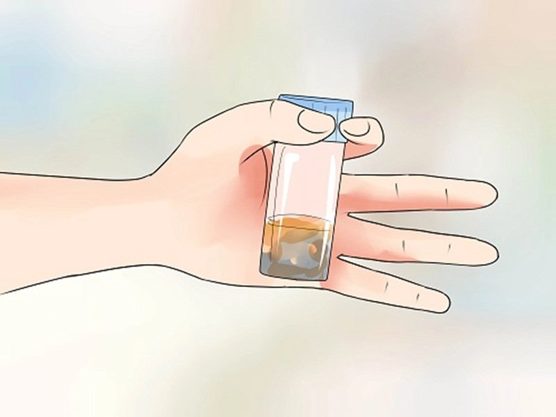 Khi nào cần xét nghiệm phân cho bé?