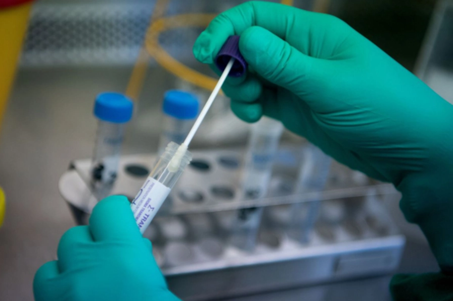 Khi nào xét nghiệm PCR SARS-COV-2 dương tính có ý nghĩa?
