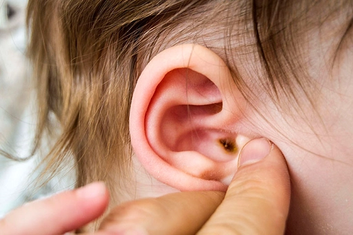 Không lấy ráy tai cho trẻ có sao không?