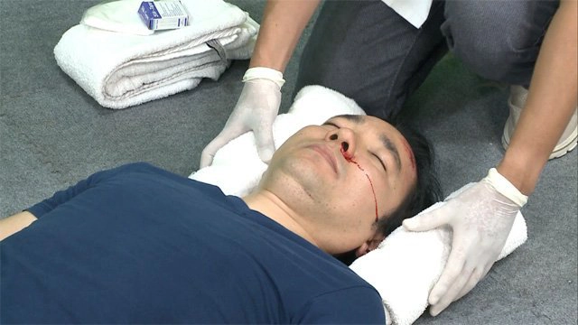 Không nhớ gì sau chấn thương sọ não có nguy hiểm không?