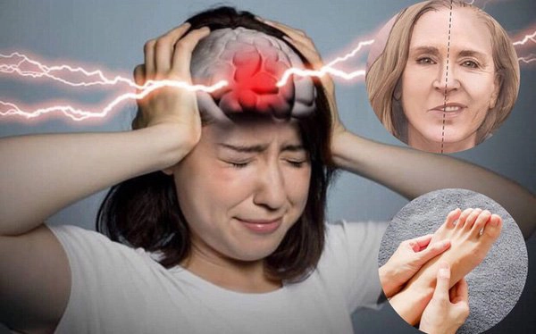 Kỹ thuật chẩn đoán hình ảnh nào đánh giá nguy cơ nhồi máu não?