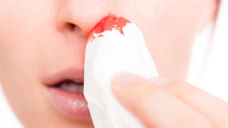 Làm gì khi bị ho và xì mũi ra máu?