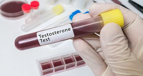 Làm sao để biết nồng độ testosterone của mình là bao nhiêu?