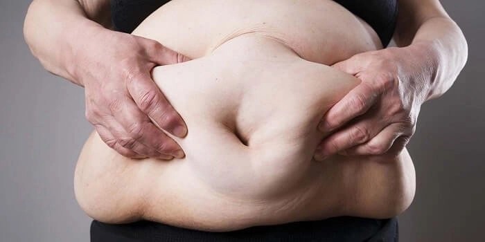 Liên quan giữa béo phì và bệnh tiểu đường type 2