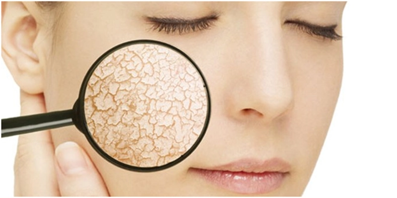 Lời khuyên hàng đầu của bác sĩ da liễu để làm giảm khô da