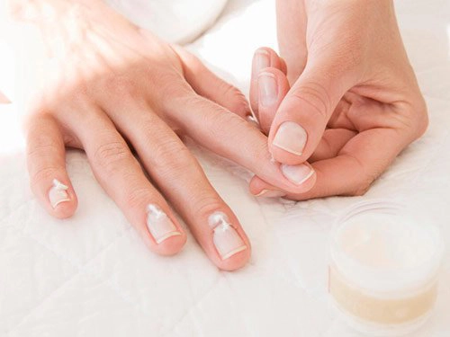 Lưu ý khi dùng thuốc bôi viêm quanh móng