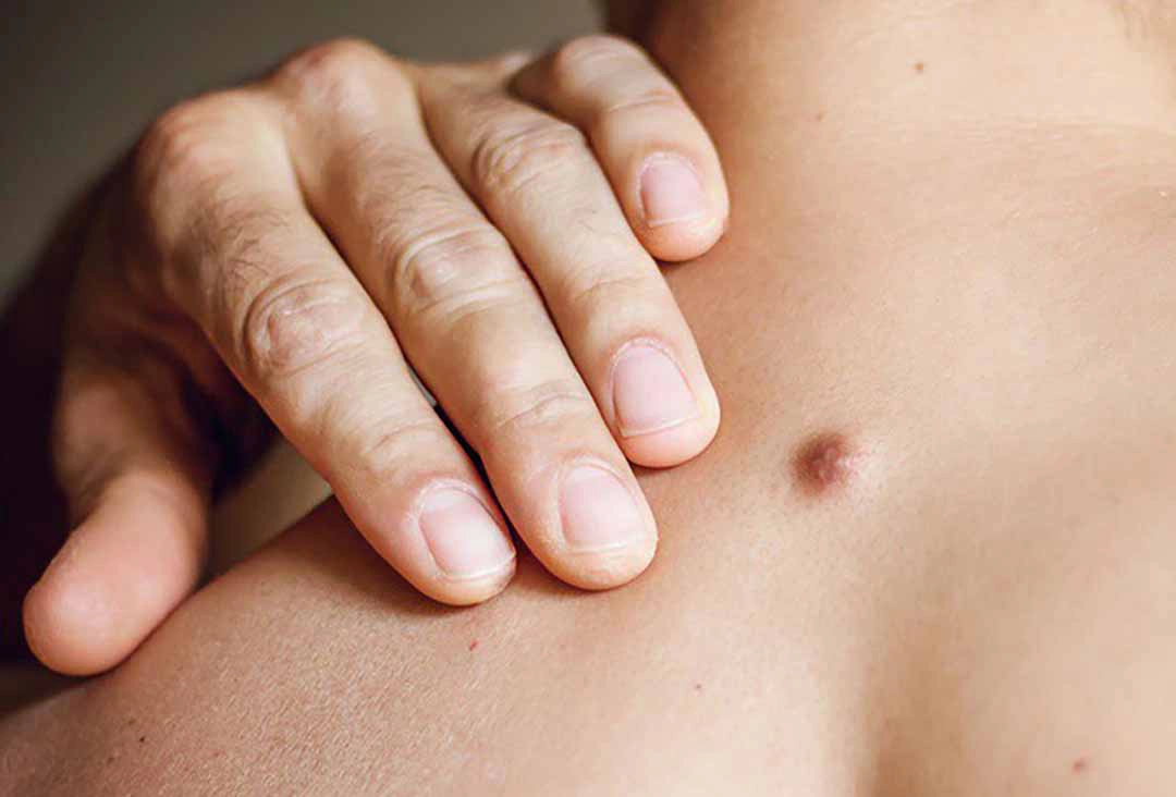 Lưu ý khi nổi cục cứng nhỏ dưới da