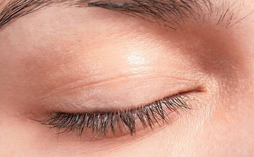 Mi dưới mắt không co giãn được sau cấy mi có nguy hiểm không?