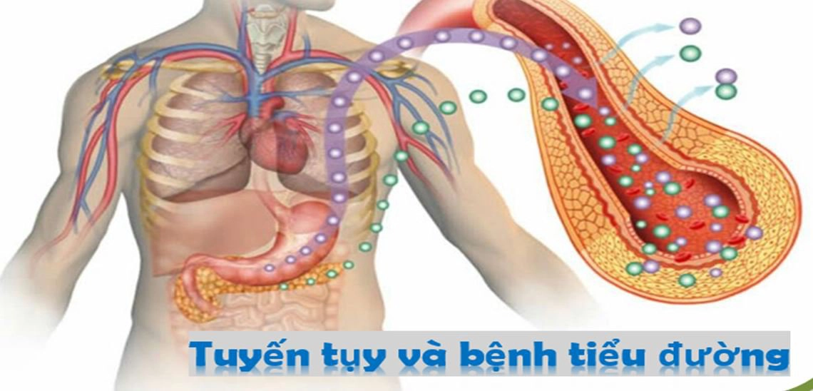 Mối liên hệ giữa bệnh đái tháo đường và tuyến tụy