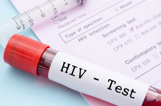 Nam giới xét nghiệm HIV nhanh Ab âm tính nên làm gì?