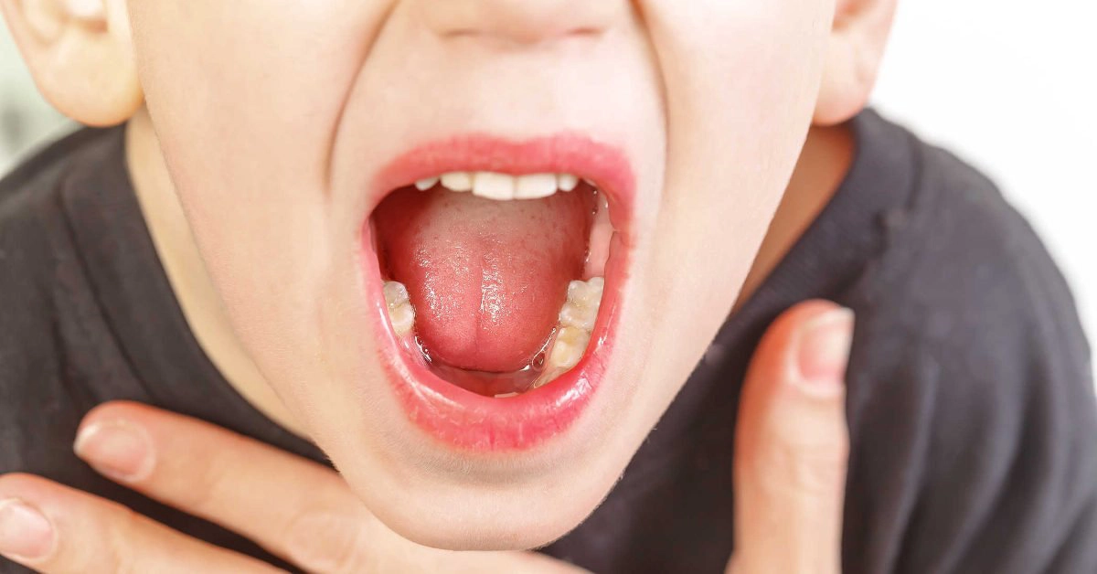 Nạo VA cho trẻ liệu có gây đau?