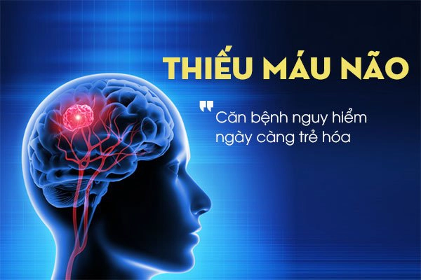 Ngất, xỉu - Dấu hiệu thiếu máu não?