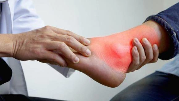 Người bị bệnh gút có ăn được canh cua không?