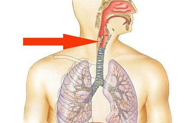 Người bị bỏng thực quản do xăng có thể để lại hậu quả gì?
