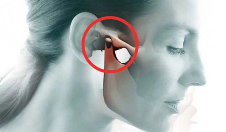 Người bị trật khớp thái dương hàm nên dùng thuốc gì?