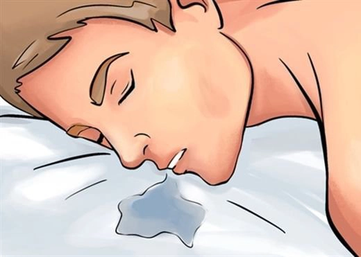 Nguyên nhân chảy nước miếng khi ngủ