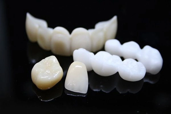 Nguyên nhân đổi màu răng sứ